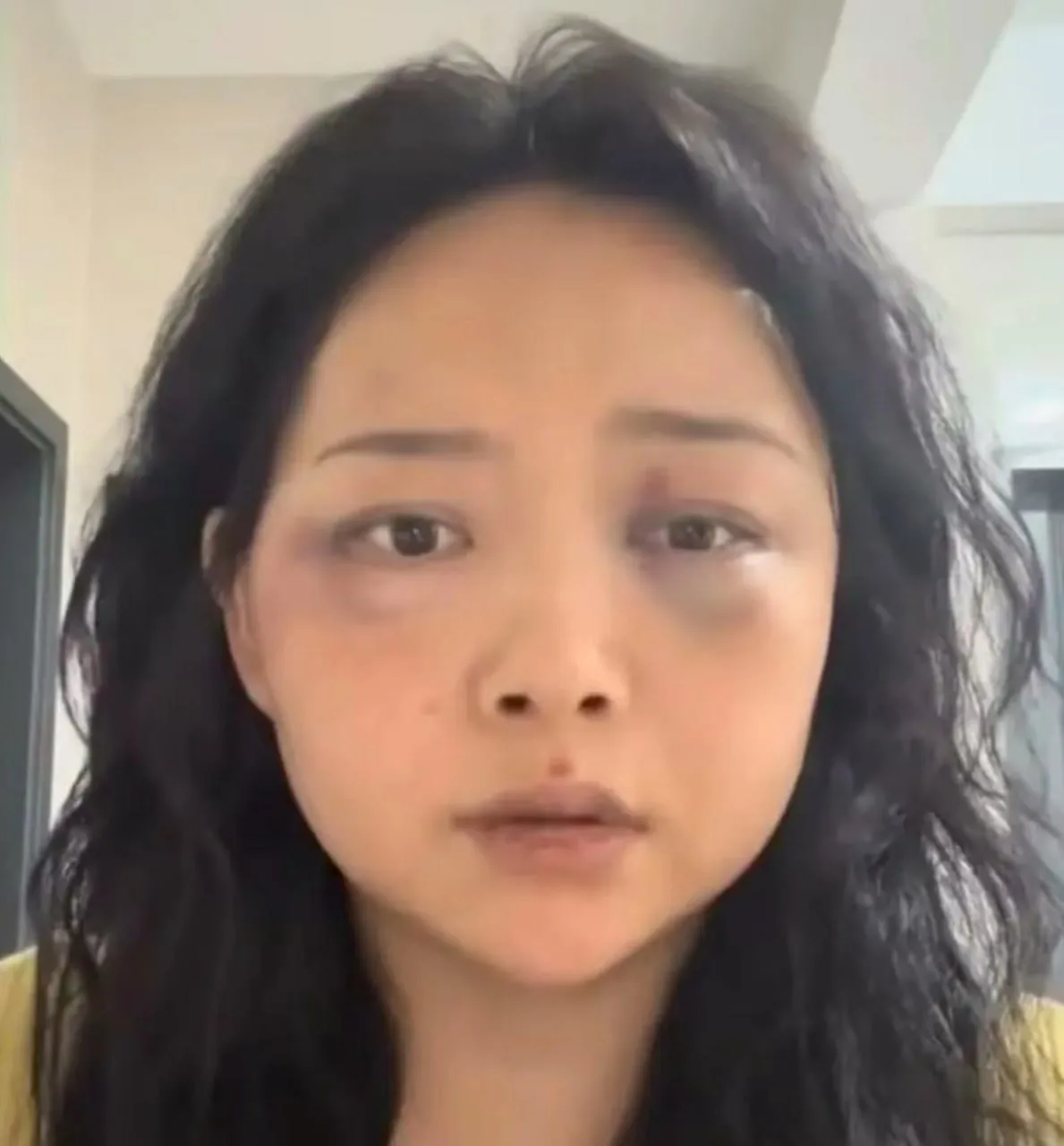 中国女子赴菲奔现后自述遭殴打，已连夜回国