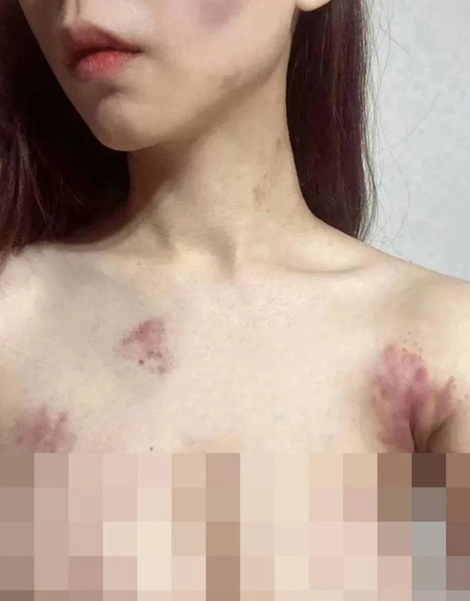 拥有700多万粉丝的世界小姐雅典娜Liya遇害事件破案了，她被闺蜜骗去菲律宾，歹徒向她家里索要80万美元后，将她残忍杀害，美好的人生刚刚开始就结束了 图片 4