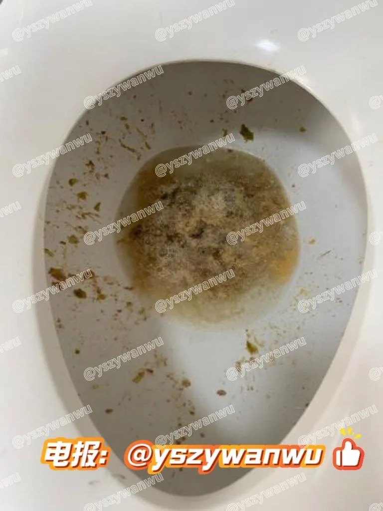 #浓痰  #呕吐物